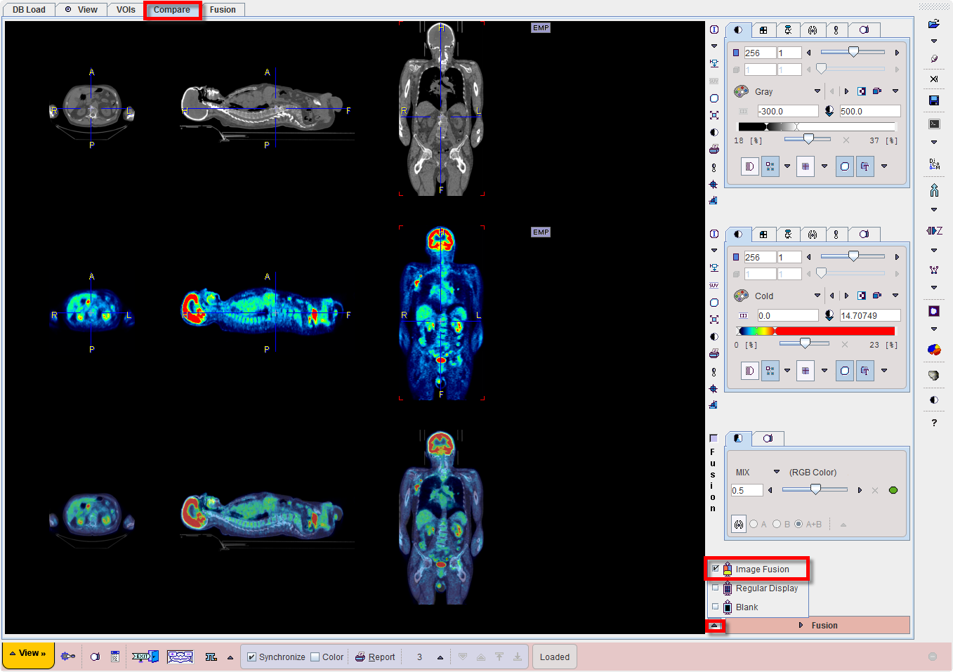 PET/CT Fusion image