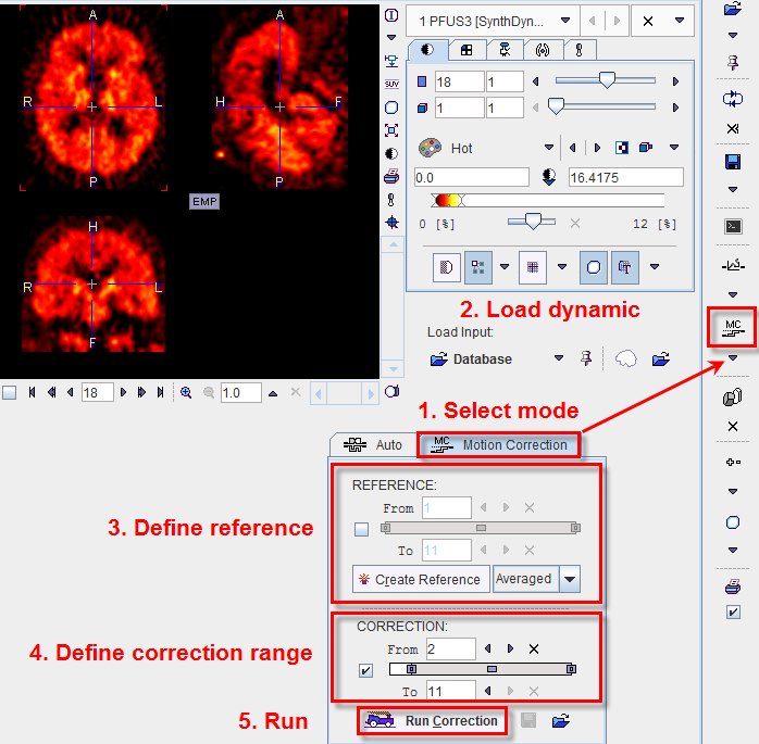 Motion Correction 1