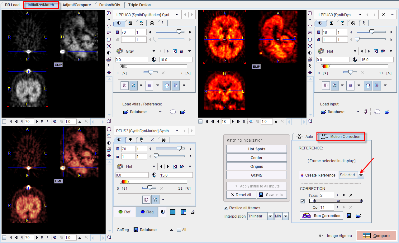 Result of Motion Correction