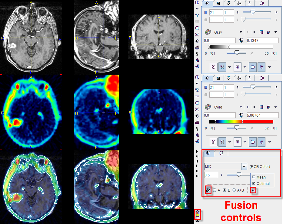 Fusion Separate Sources