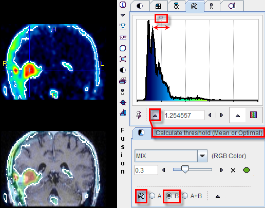 Fusion Iso-Contour